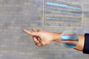 Myo Wristband: Wearable Gesture Control for Gadgets