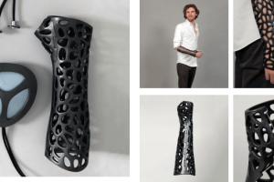 3D Printed: Osteoid Medical Cast