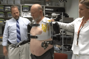 Man Controls 2 Prosthetic Arms Using His Mind