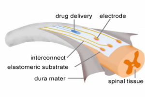 Neural Implant Restores Walking In Paralyzed Subject