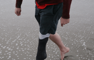 Water Leg: Prosthetic Leg for the Beach