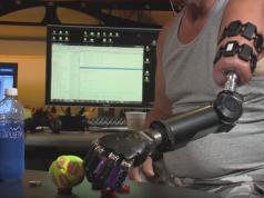 Myo-controlled Prosthetic Arm