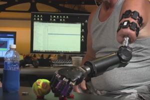 Myo-controlled Prosthetic Arm