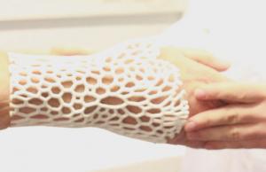 Curatio: 3D Hand Scanner for Perfect Braces