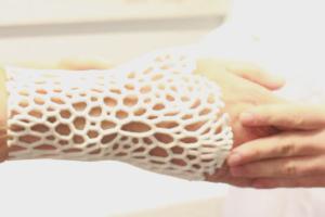 Curatio: 3D Hand Scanner for Perfect Braces