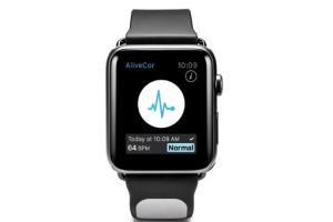 Kardia EKG Band for Apple Watch