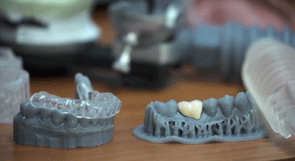 3d printing dentist