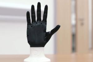 Open Bionics 3D Printed Prosthetic Limbs
