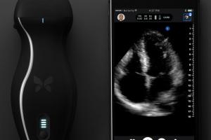 Butterfly iQ Ultrasound On a Chip for iPhone
