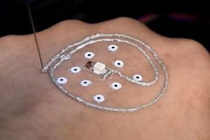 Researchers 3D Print Electronics on Human Skin