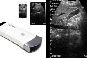 SonoQue C3 Portable Wireless Ultrasound Scanner for iPhone