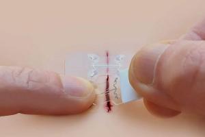 microMend Emergency Wound Closures