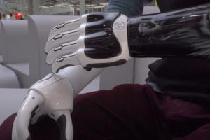 Indy Hand: Bionic Prosthetic Hand with App